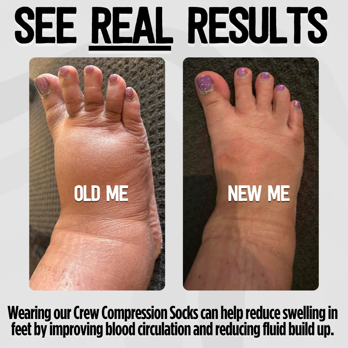 White Crew Length Compression Socks - Image 8